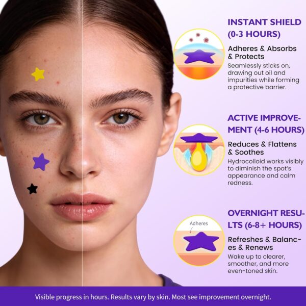 DATISEP Star Hydrocolloid Pimple Patches (560 Count) – 7 Colors Acne Spot Stickers