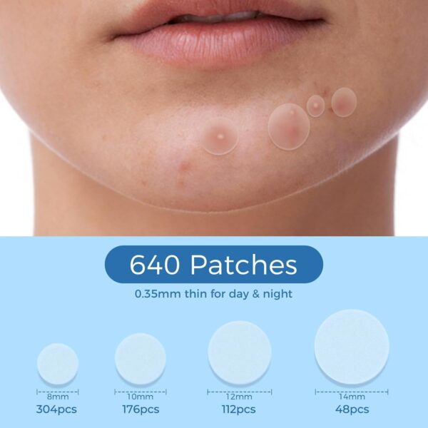 Pimple Patches for Face, 640 Count Hydrocolloid Patch Acne Patches,4 Sizes Zit Patches for Covering, Blemishes and Breakouts, Dots Stickers with Salicylic Acid, Tea Tree Oil & Calendula Oil
